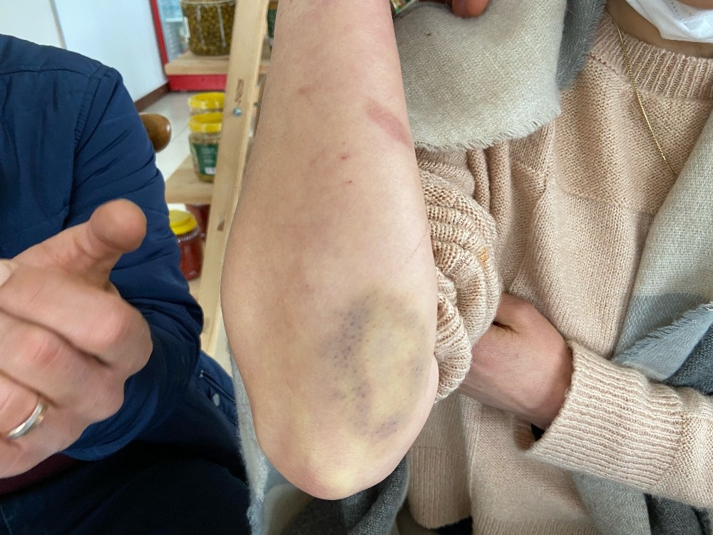 Beylikdüzü´nde hırsızları engellemeye çalışırken ölümden dönen karı-koca dehşet anlarını anlattı
