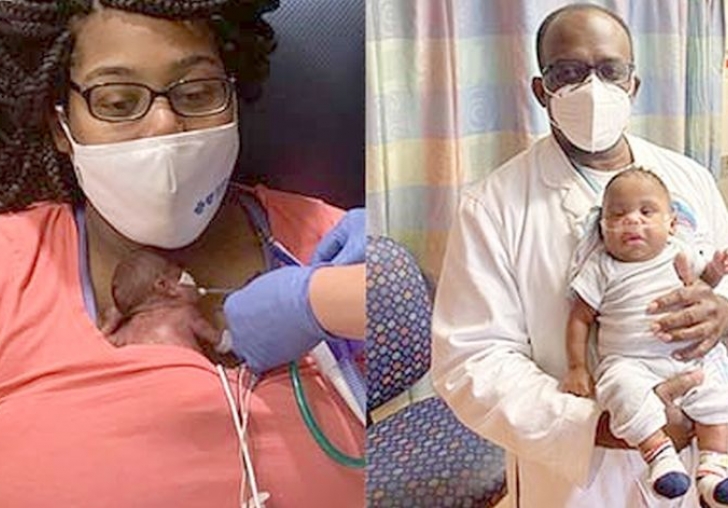 Dünyanın En Erken Doğan Bebeği