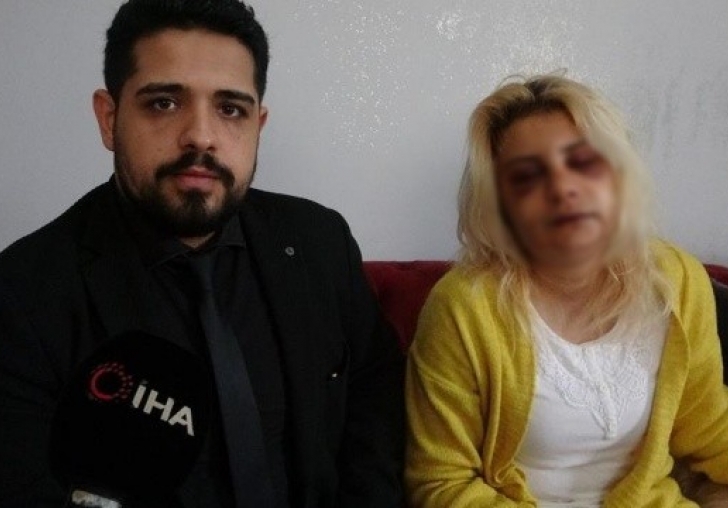 Evde kabusu yaşadı! 2 saat aralıksız dövdüler