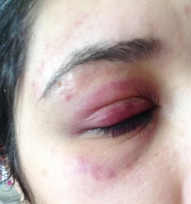 Genç kızı darp eden avukat: 