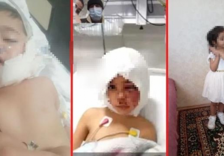 Pitbull saldırısına uğrayan minik Asiye'den ilk hastane fotoğrafı geldi